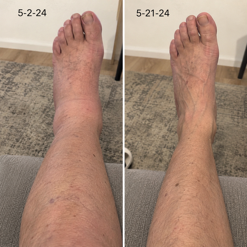 using Boheads less than 8 weeks