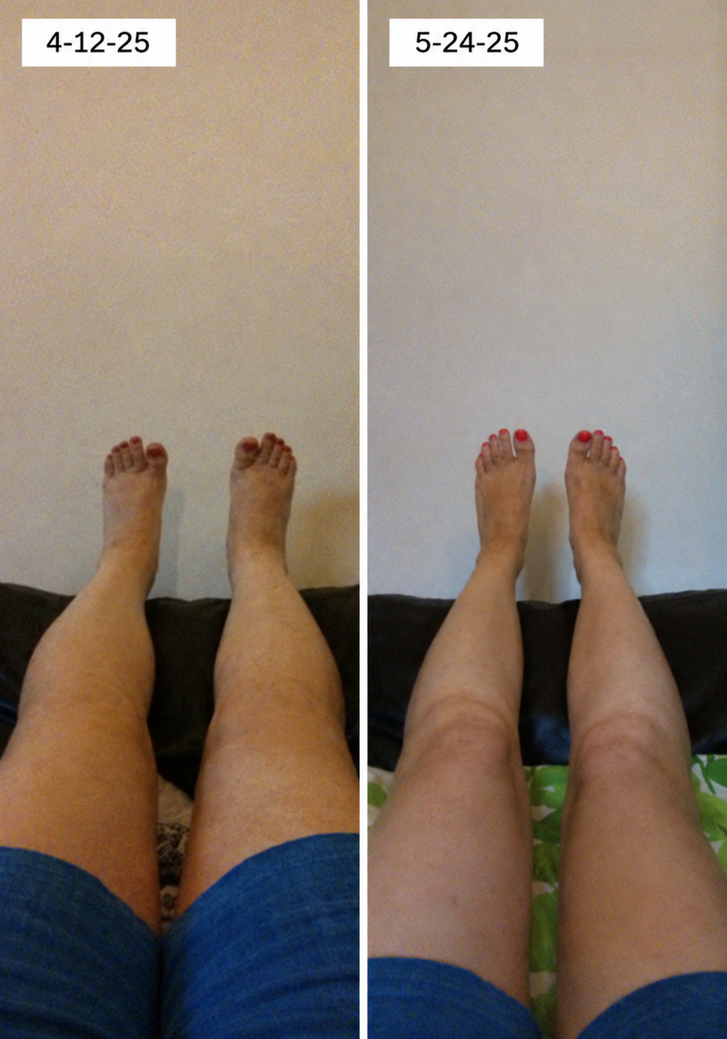 using Boheads less than 8 weeks