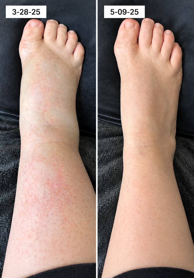 using Boheads less than 8 weeks